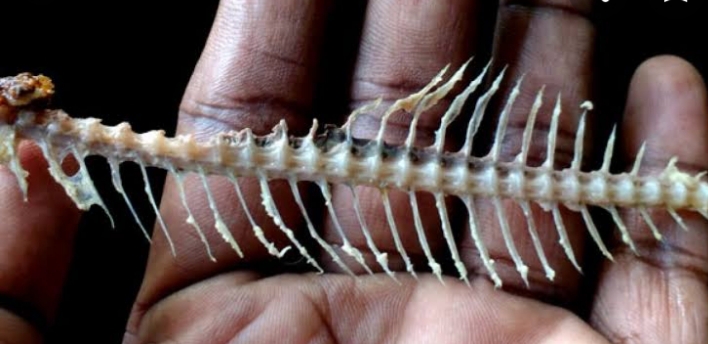 মাছের কাঁটা বিঁধলে গলায় যা করণীয়