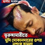 ভূরুঙ্গামারীতে মুদি দোকানদারকে চাপাতি দিয়ে কুপিয়ে হত্যাচেষ্টা, মোবাইল ও টাকার ব্যাগ লুটের অভিযোগ
